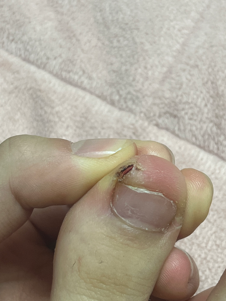 2번 째 사진