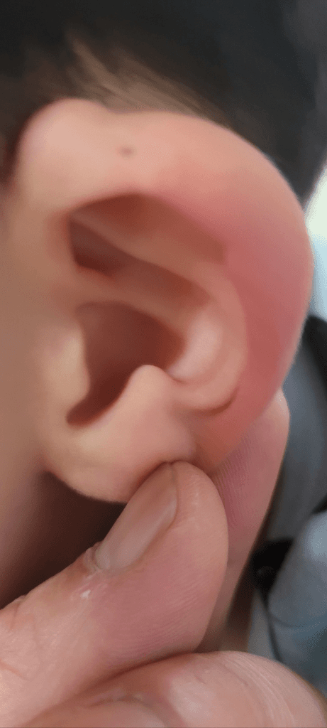 3번 째 사진
