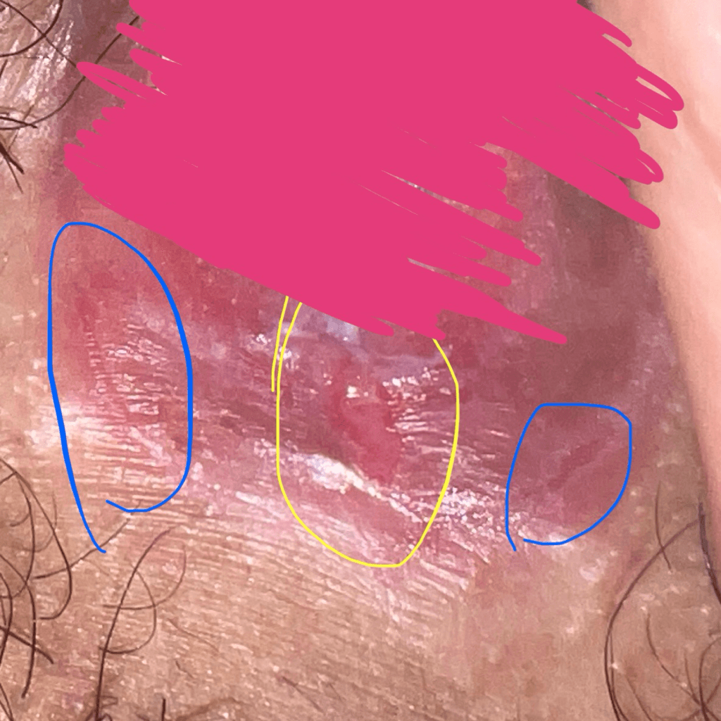 2번 째 사진