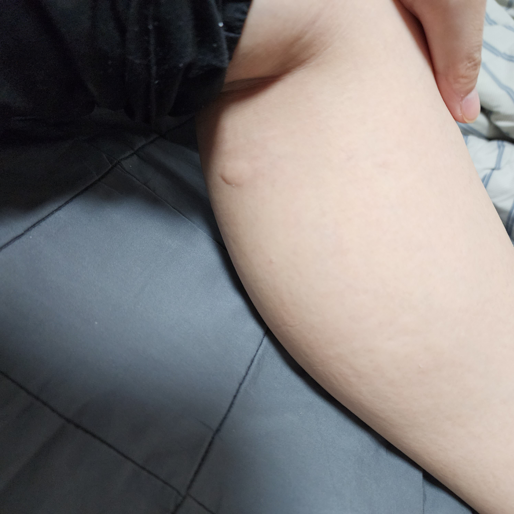 2번 째 사진