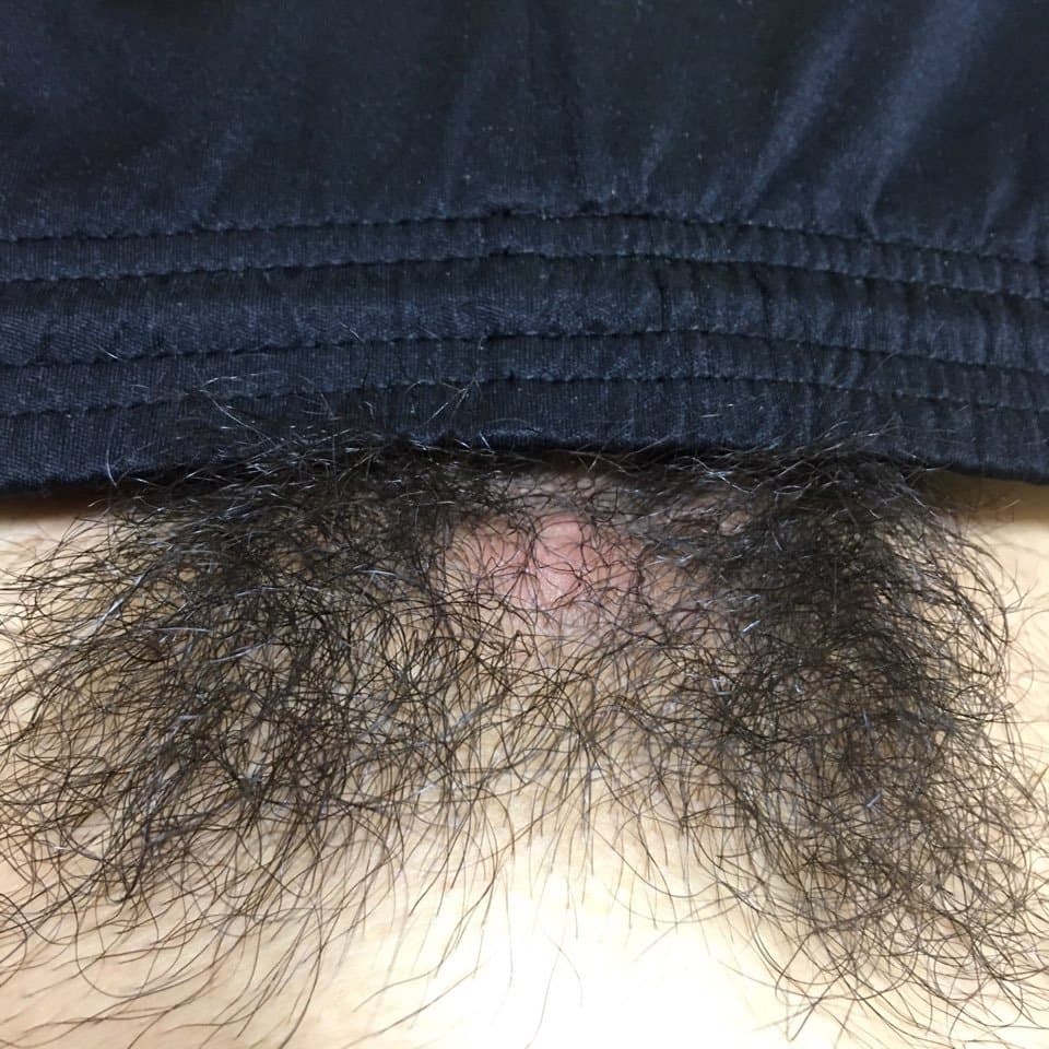 2번 째 사진