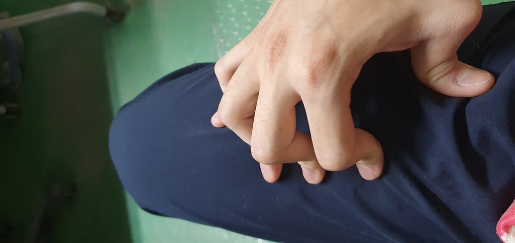 2번 째 사진