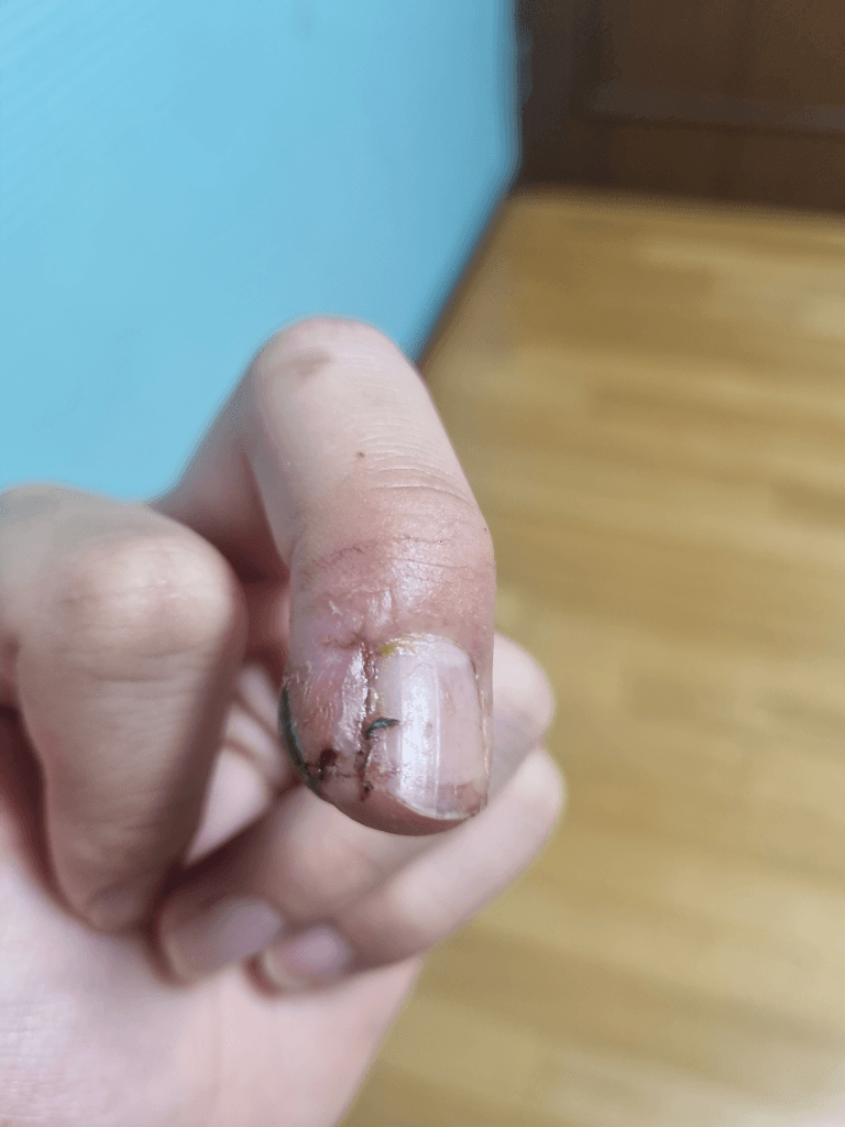 1번 째 사진