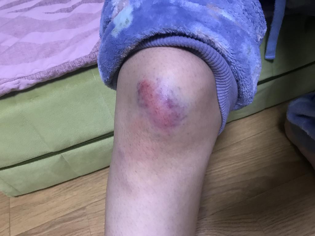 1번 째 사진