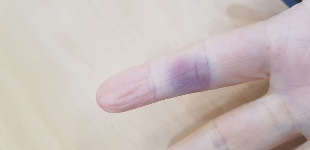 1번 째 사진