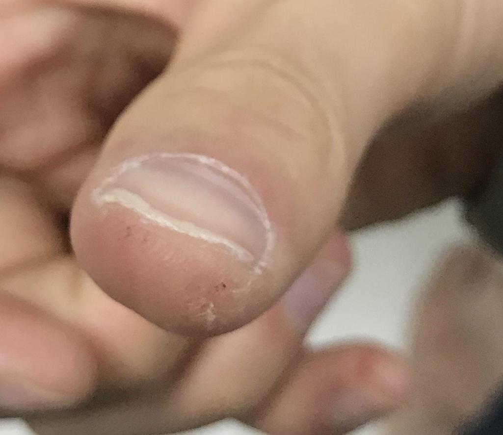 3번 째 사진