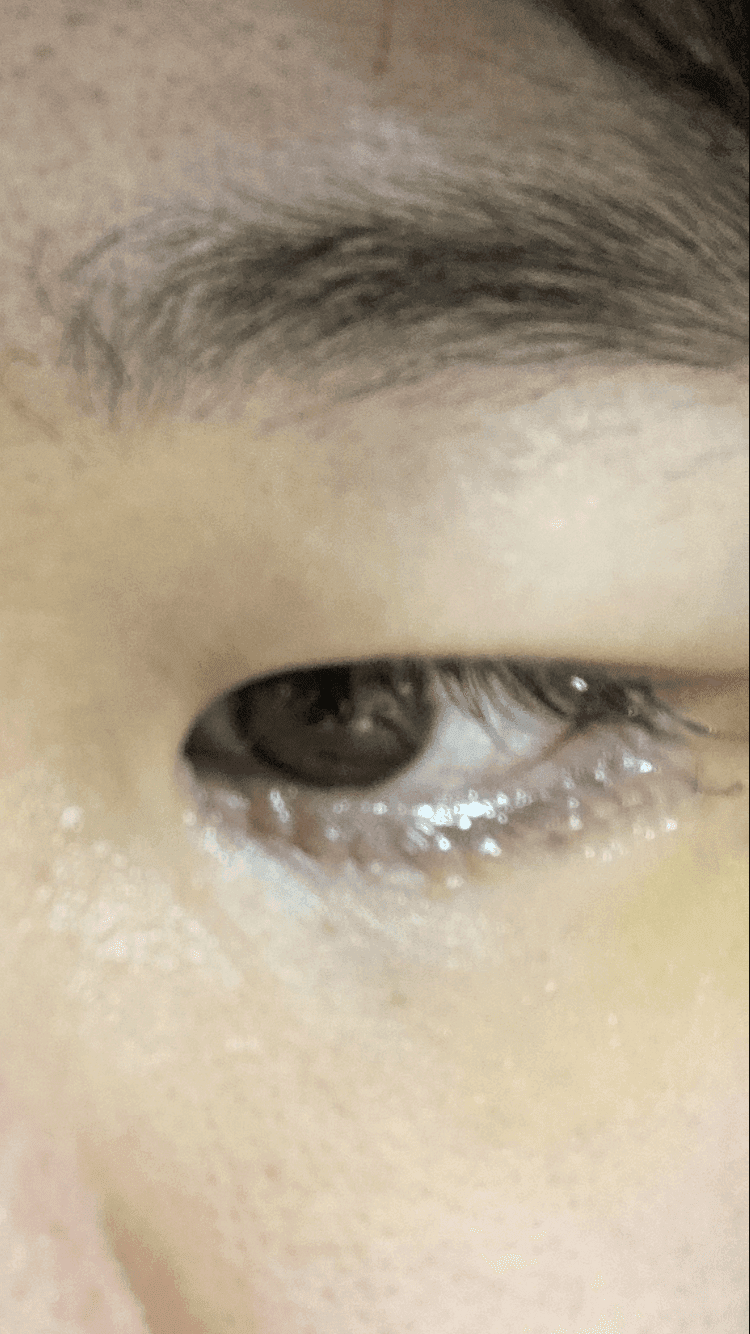 2번 째 사진