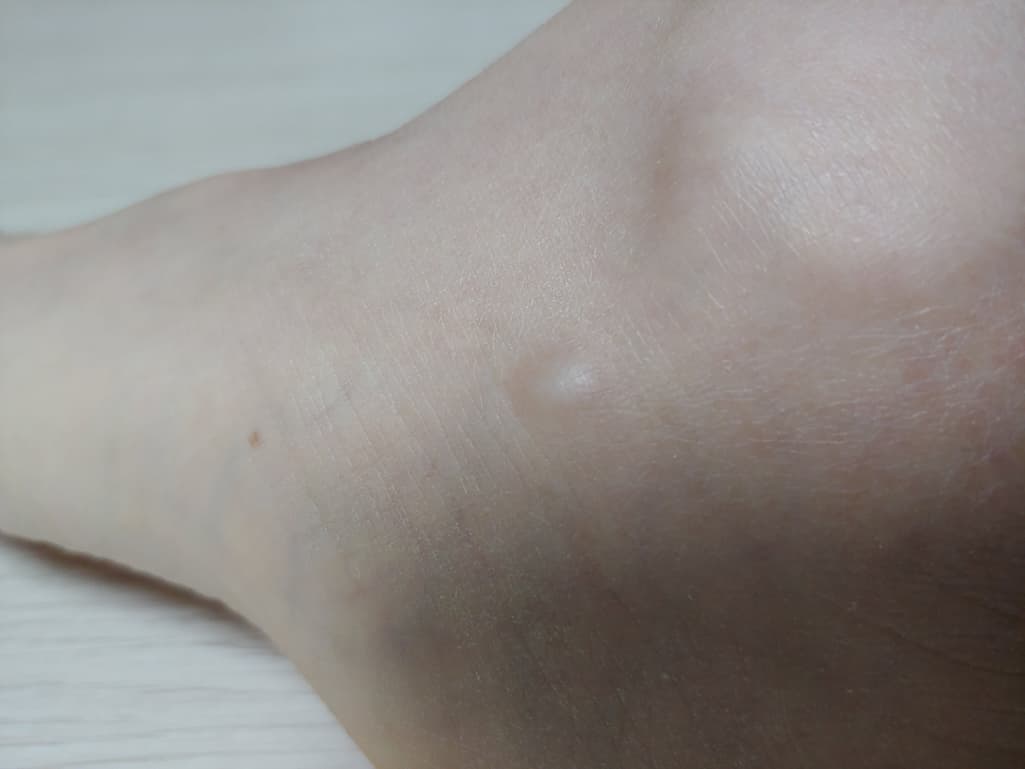 2번 째 사진