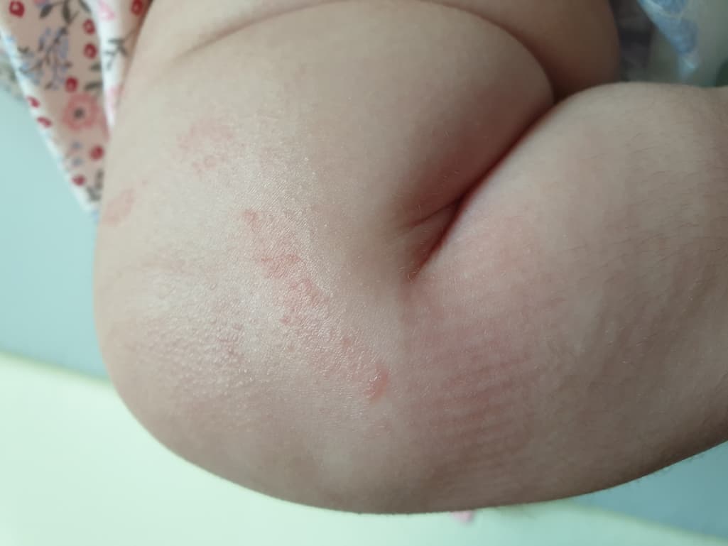 3번 째 사진
