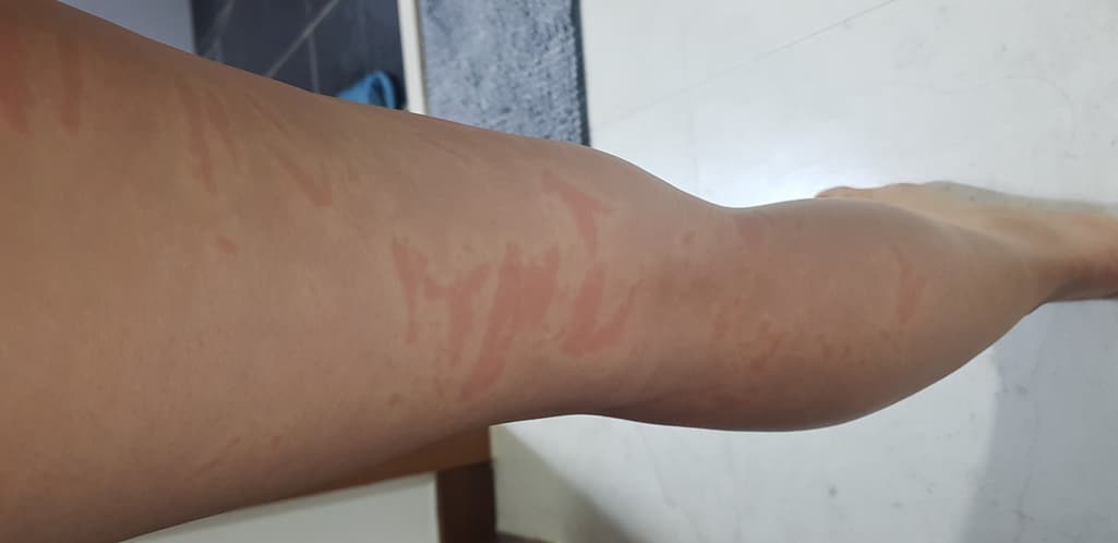 3번 째 사진