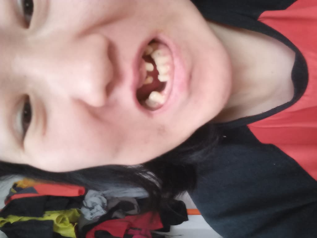 2번 째 사진