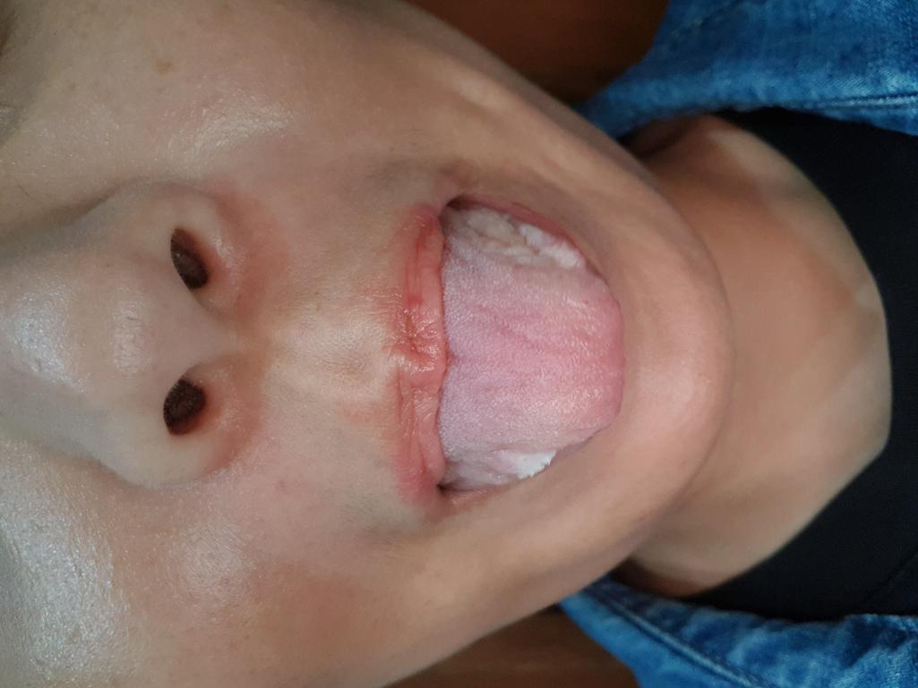 2번 째 사진