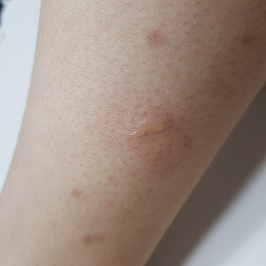 3번 째 사진