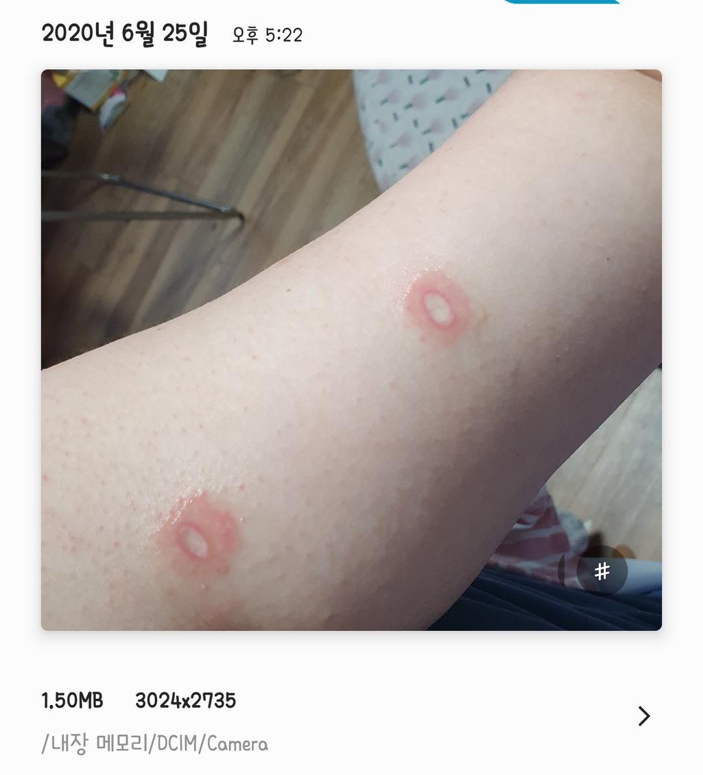 2번 째 사진
