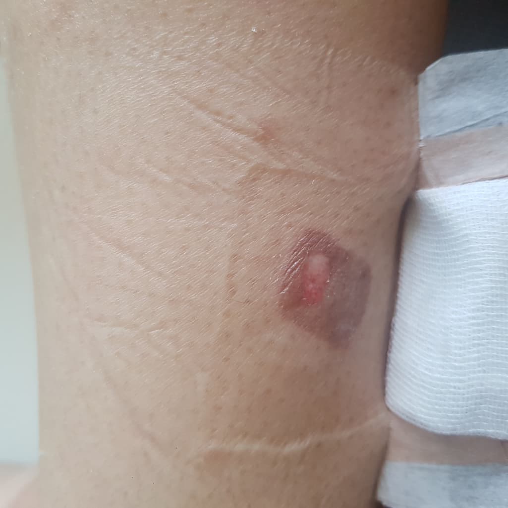 2번 째 사진