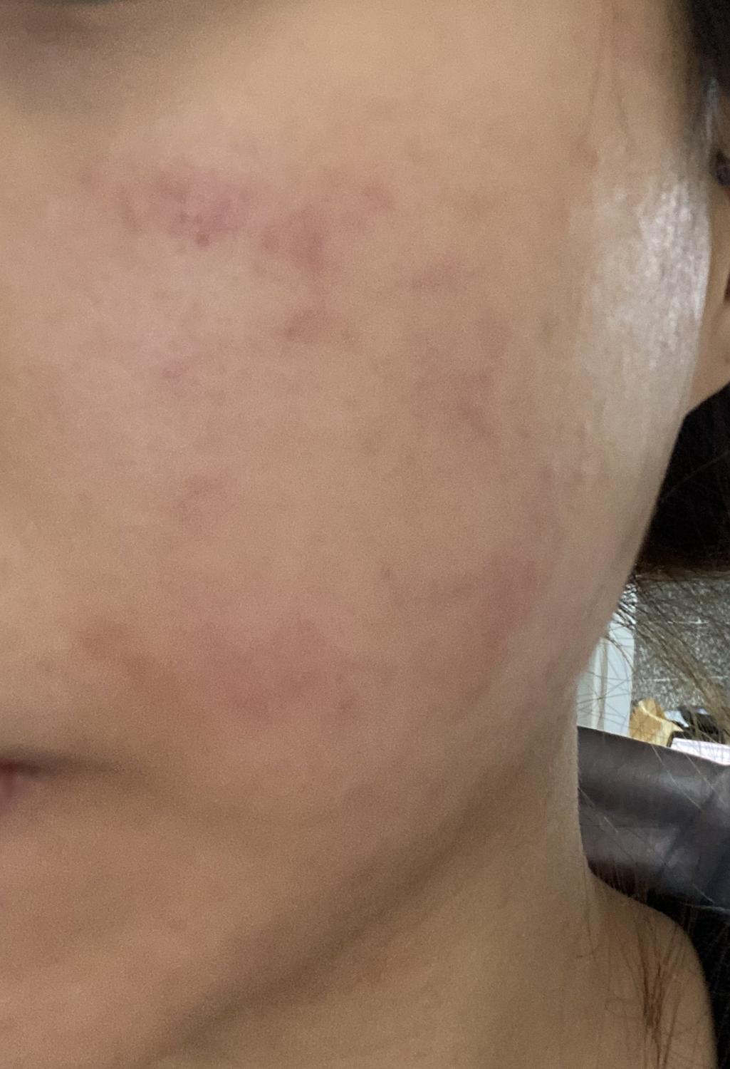 2번 째 사진