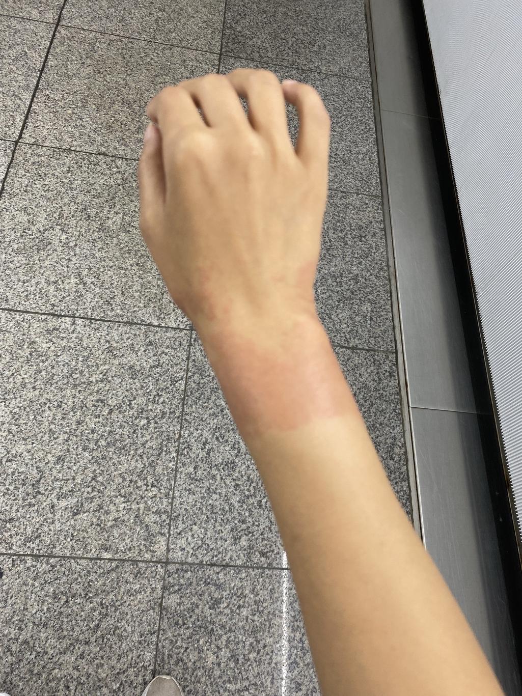 2번 째 사진