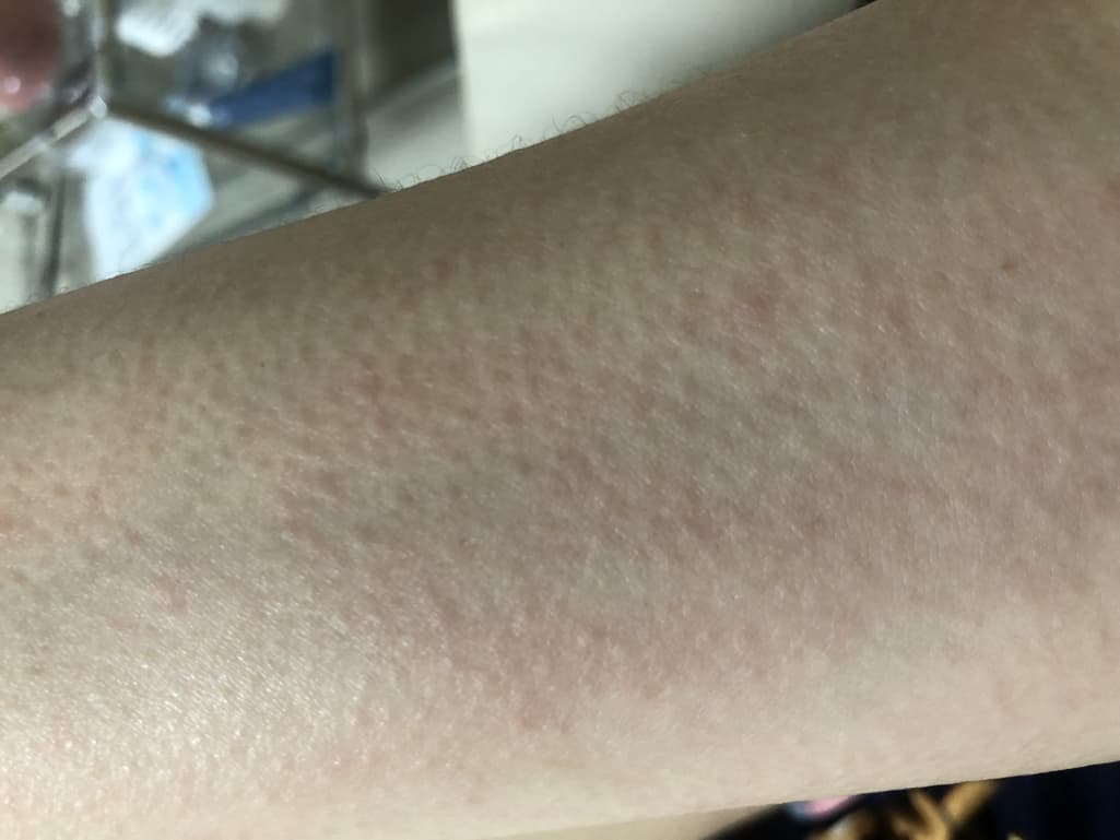 2번 째 사진