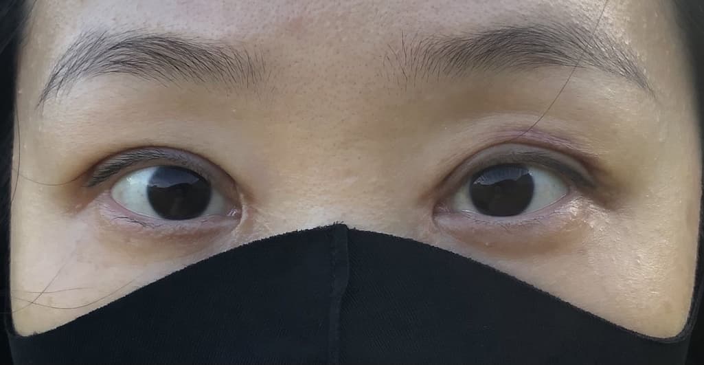2번 째 사진