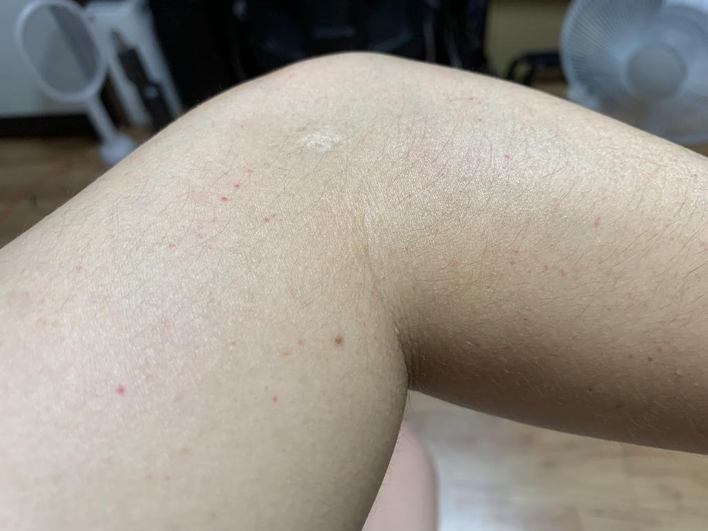 5번 째 사진
