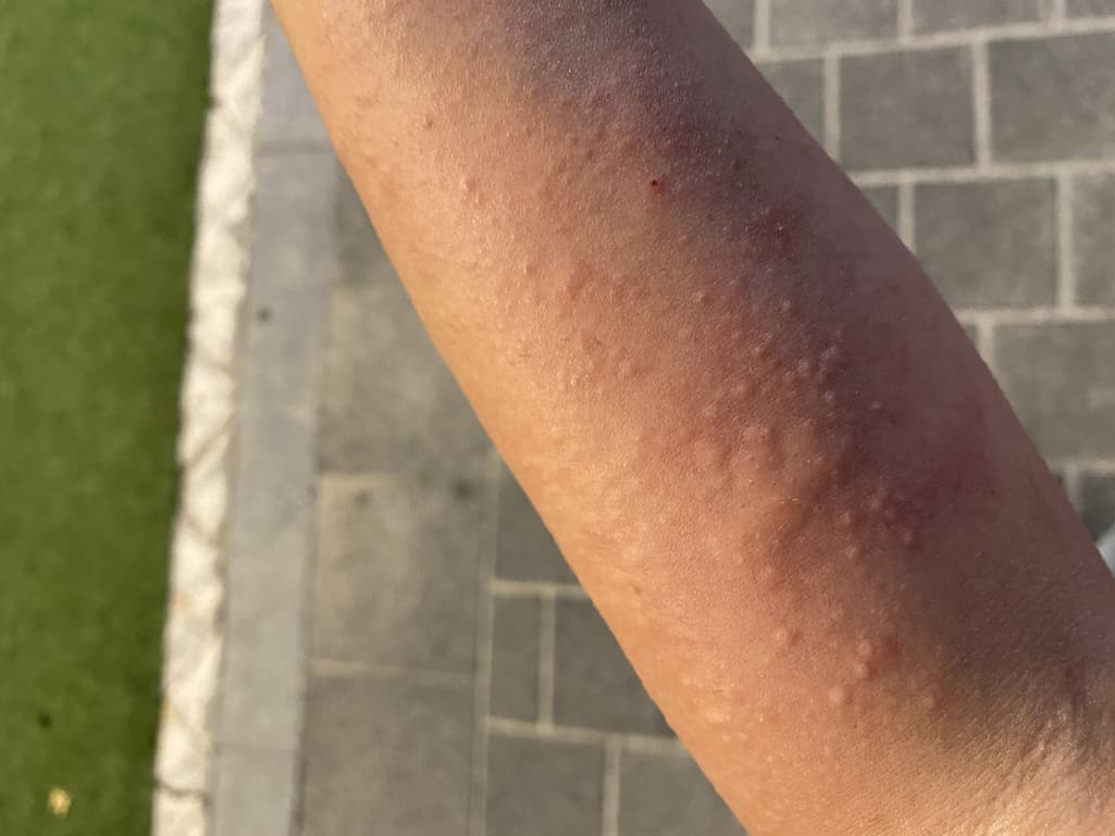 1번 째 사진