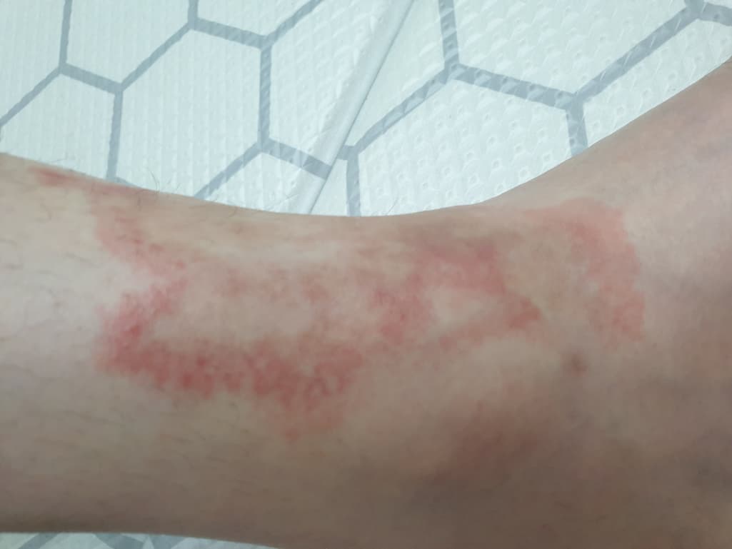 2번 째 사진