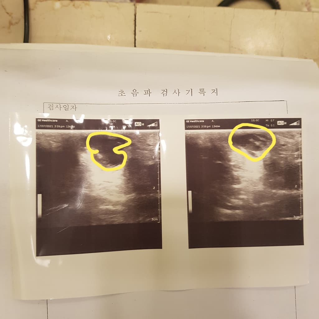 2번 째 사진