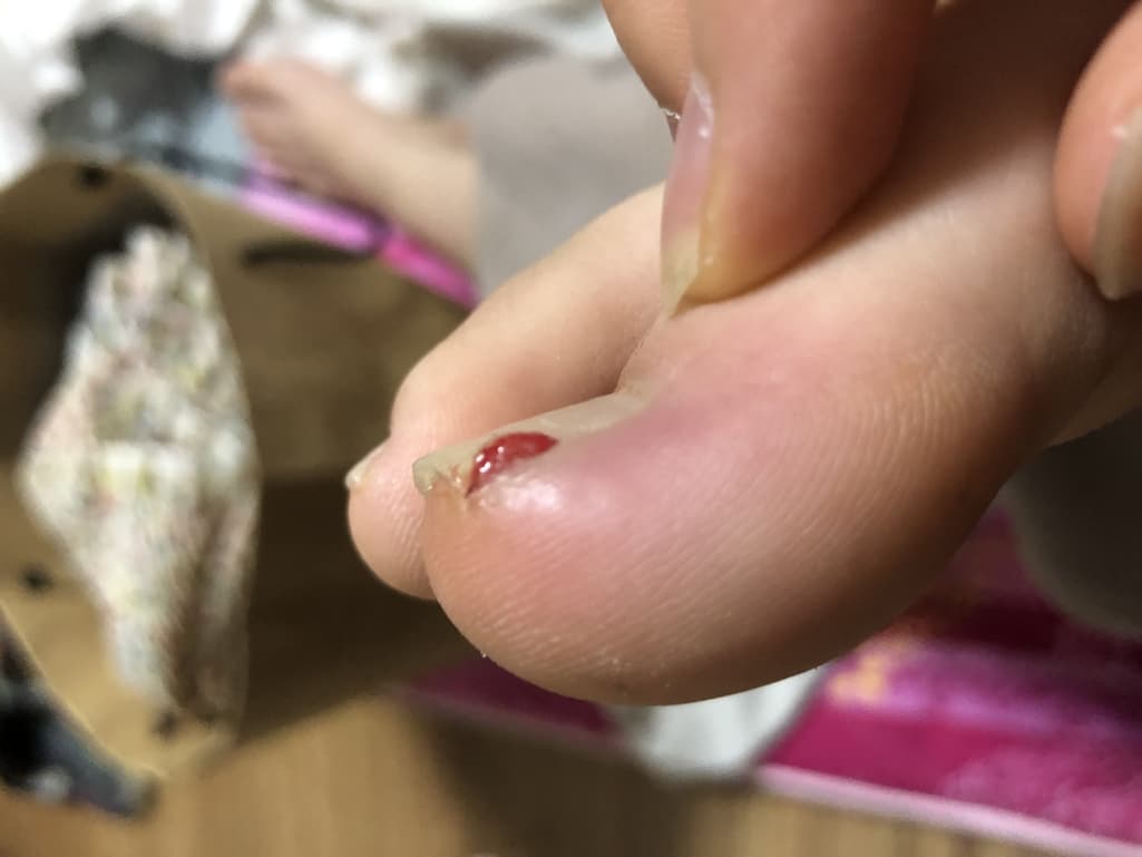2번 째 사진