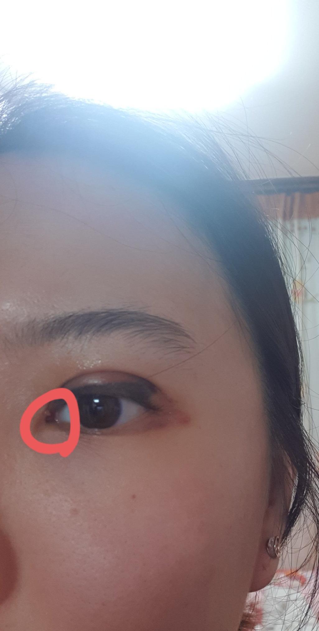 2번 째 사진