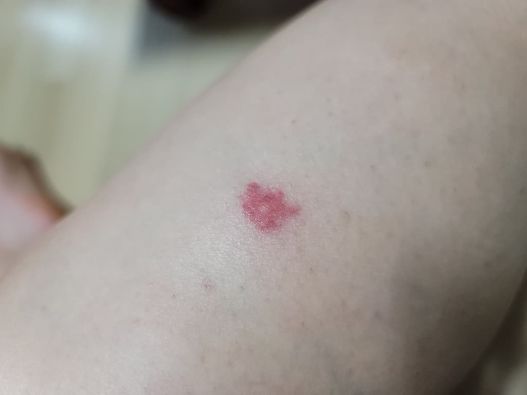 1번 째 사진