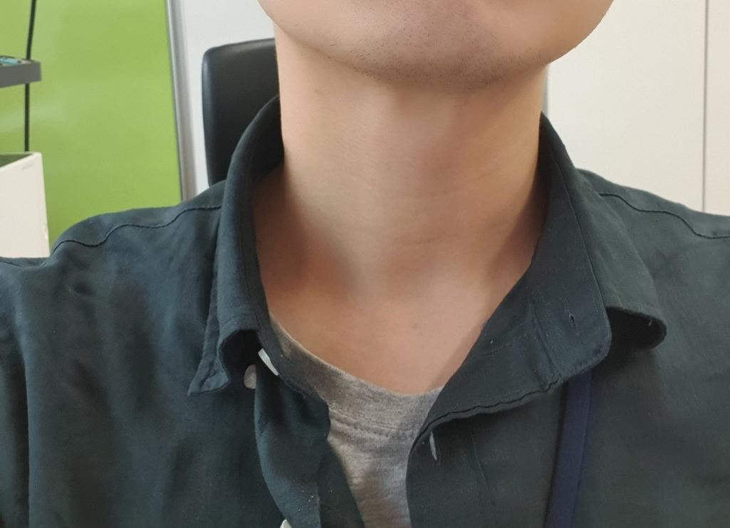 2번 째 사진