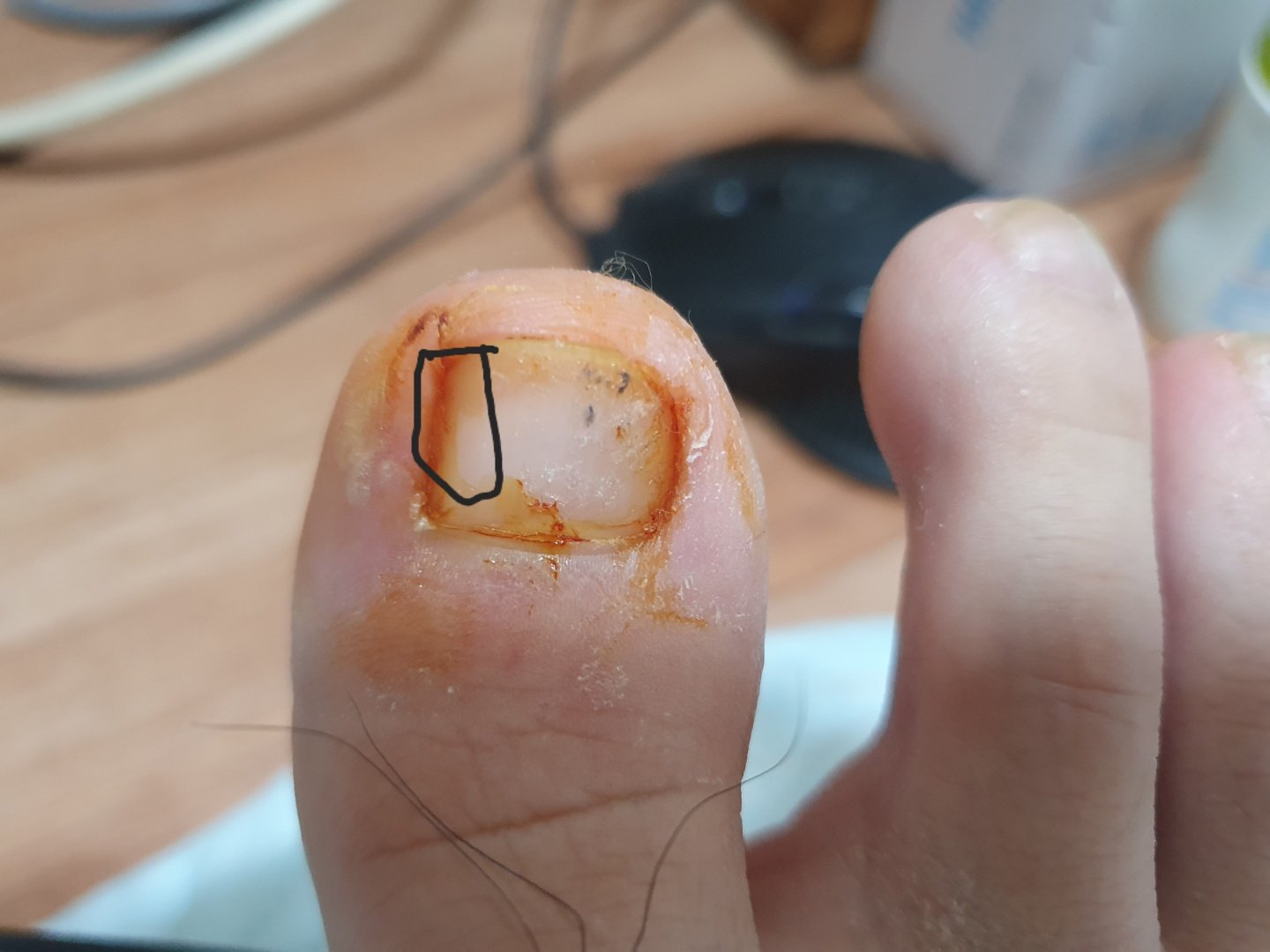 1번 째 사진