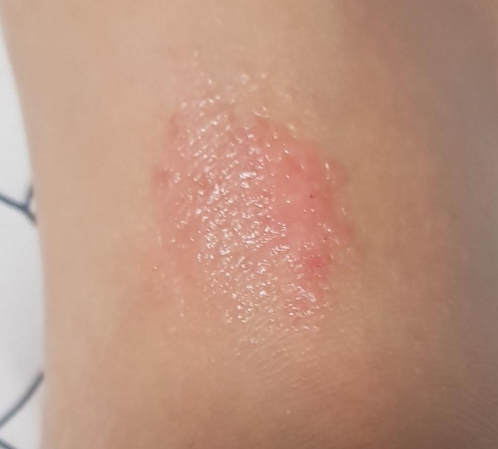 2번 째 사진