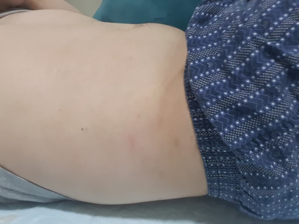 2번 째 사진