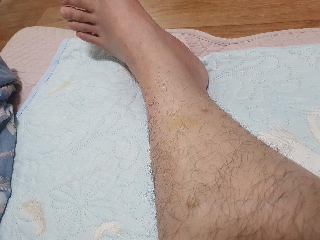 1번 째 사진
