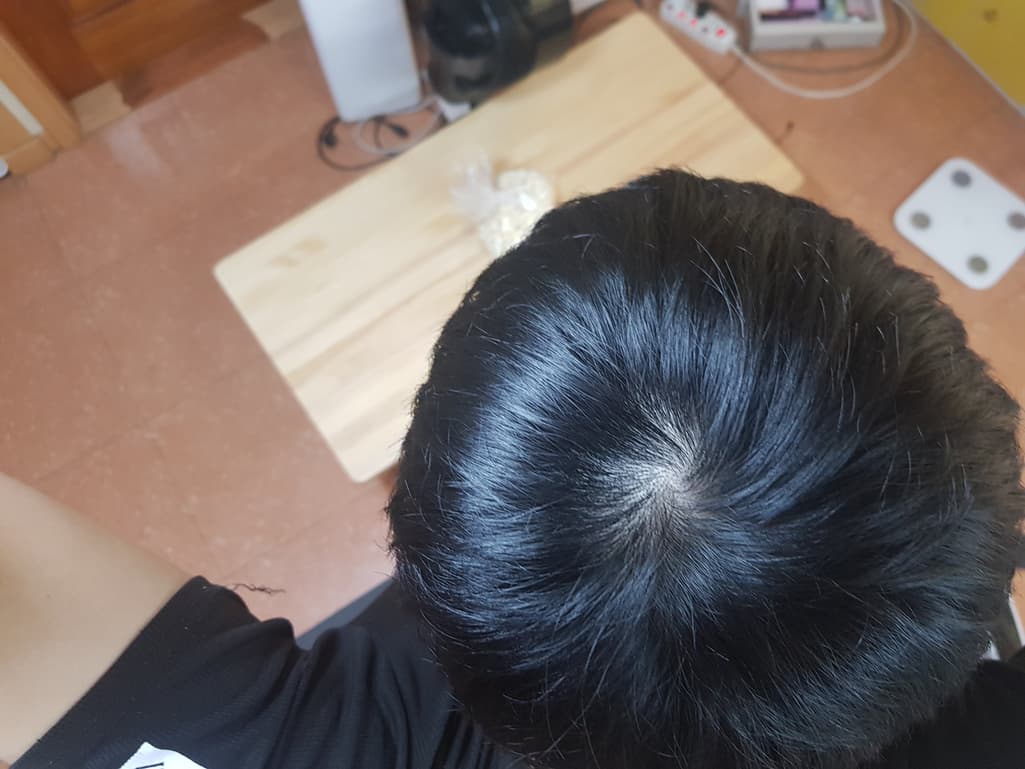 2번 째 사진