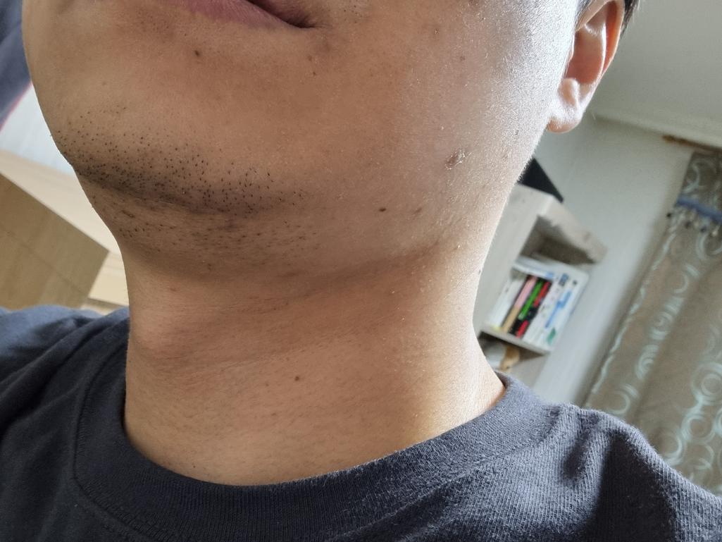 2번 째 사진