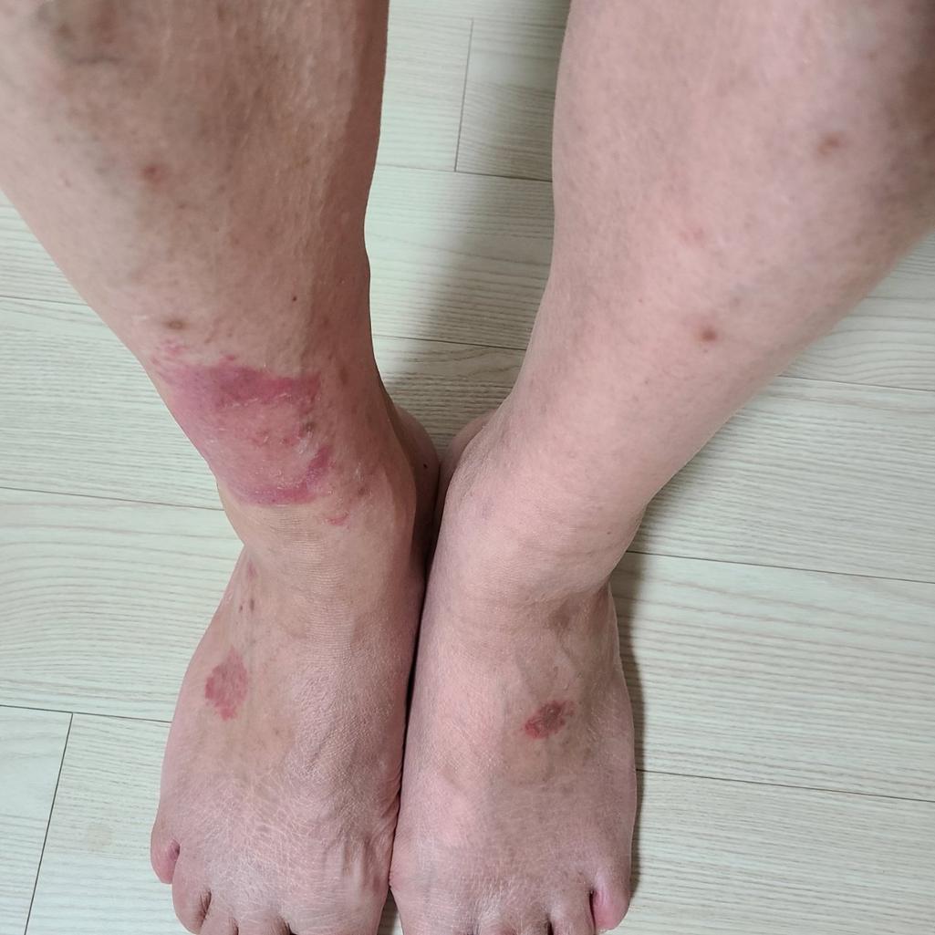 1번 째 사진