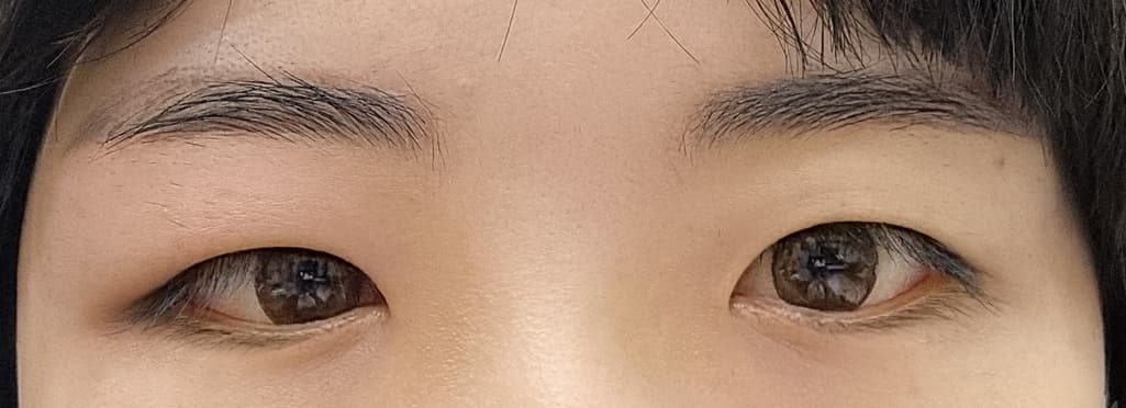 2번 째 사진