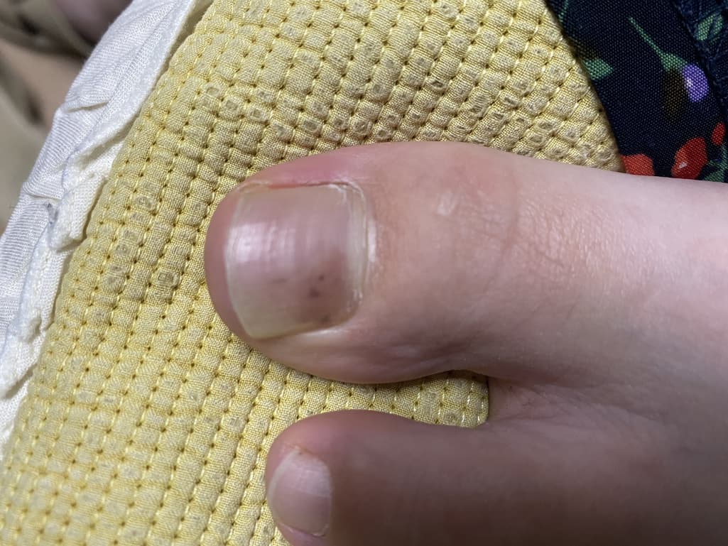 2번 째 사진