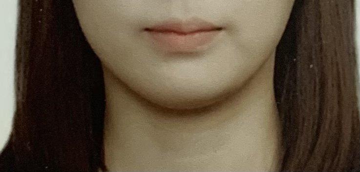 2번 째 사진