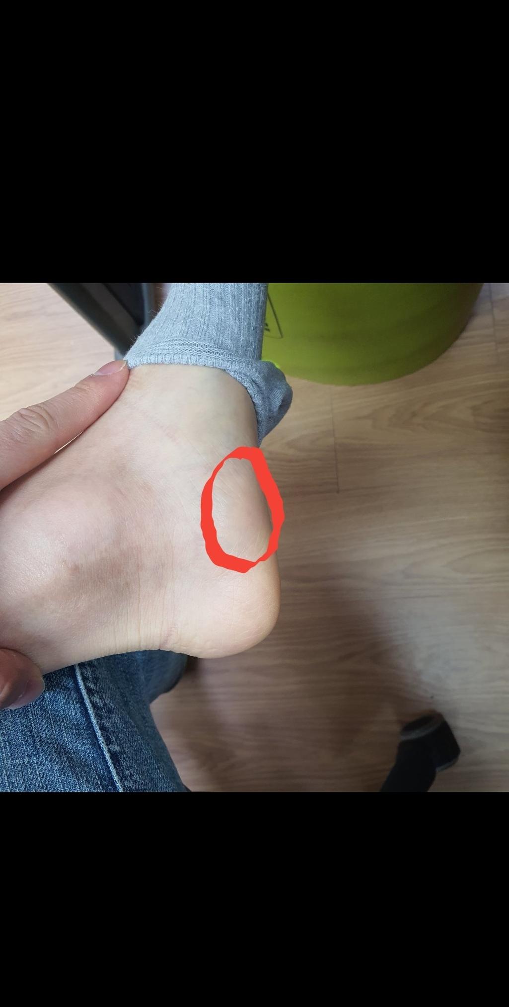 2번 째 사진