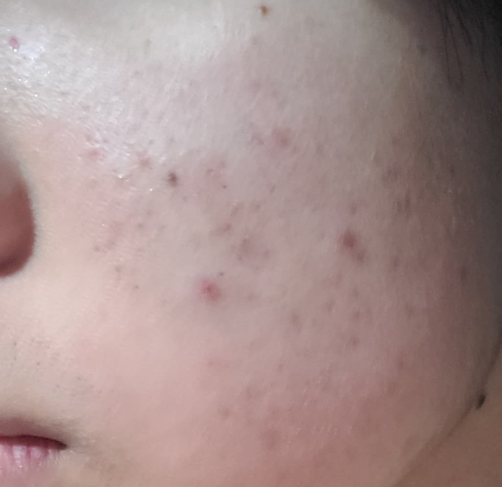 2번 째 사진