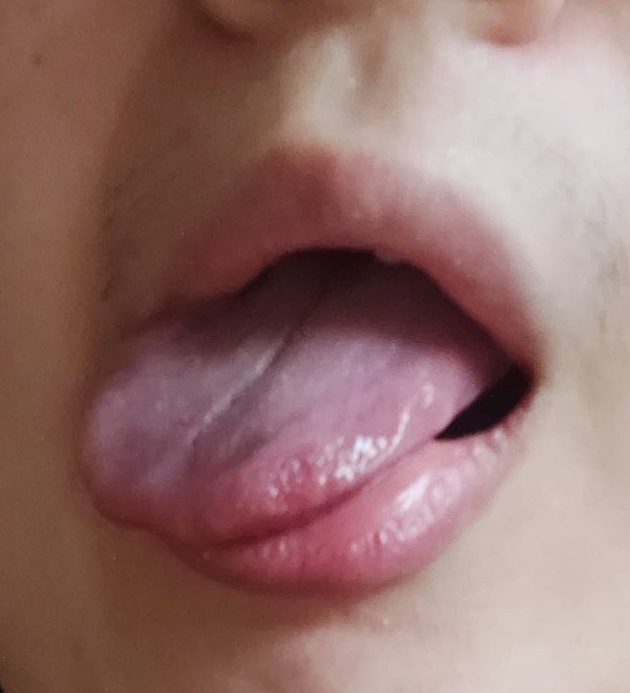 2번 째 사진