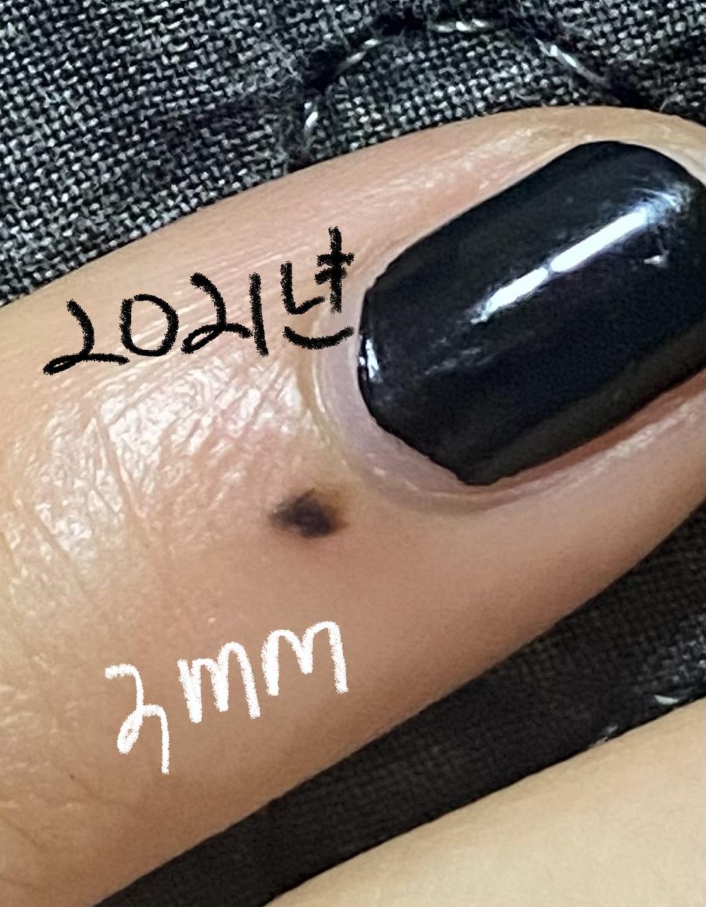 2번 째 사진
