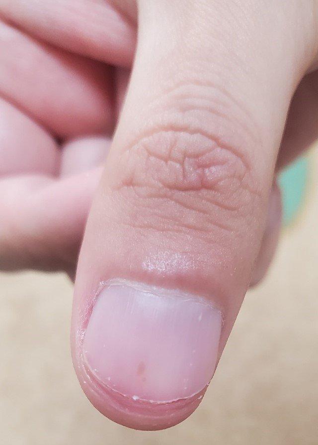 2번 째 사진