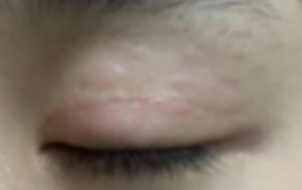 3번 째 사진