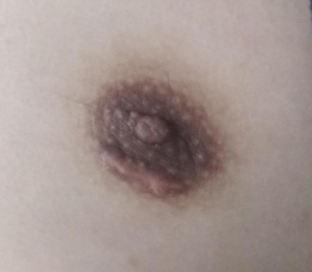 2번 째 사진