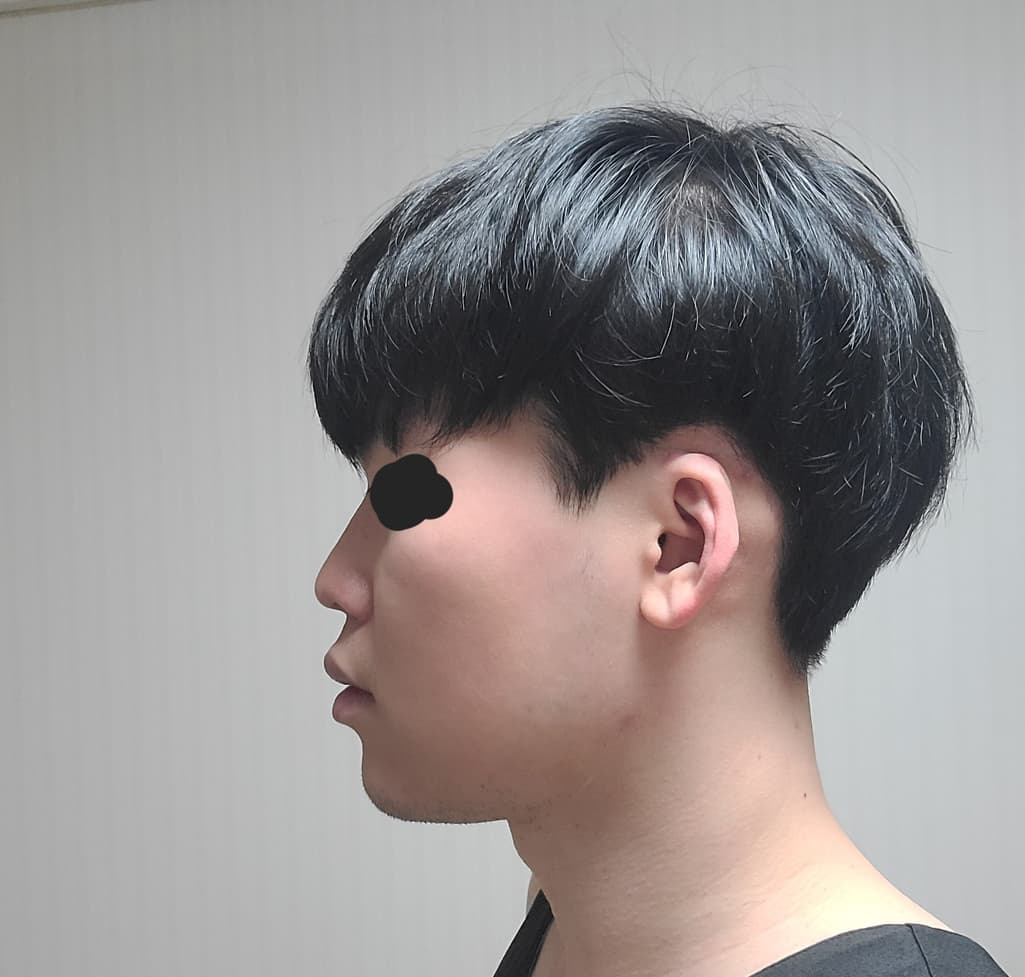 2번 째 사진
