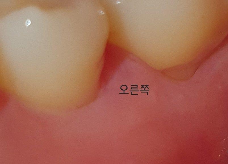 2번 째 사진